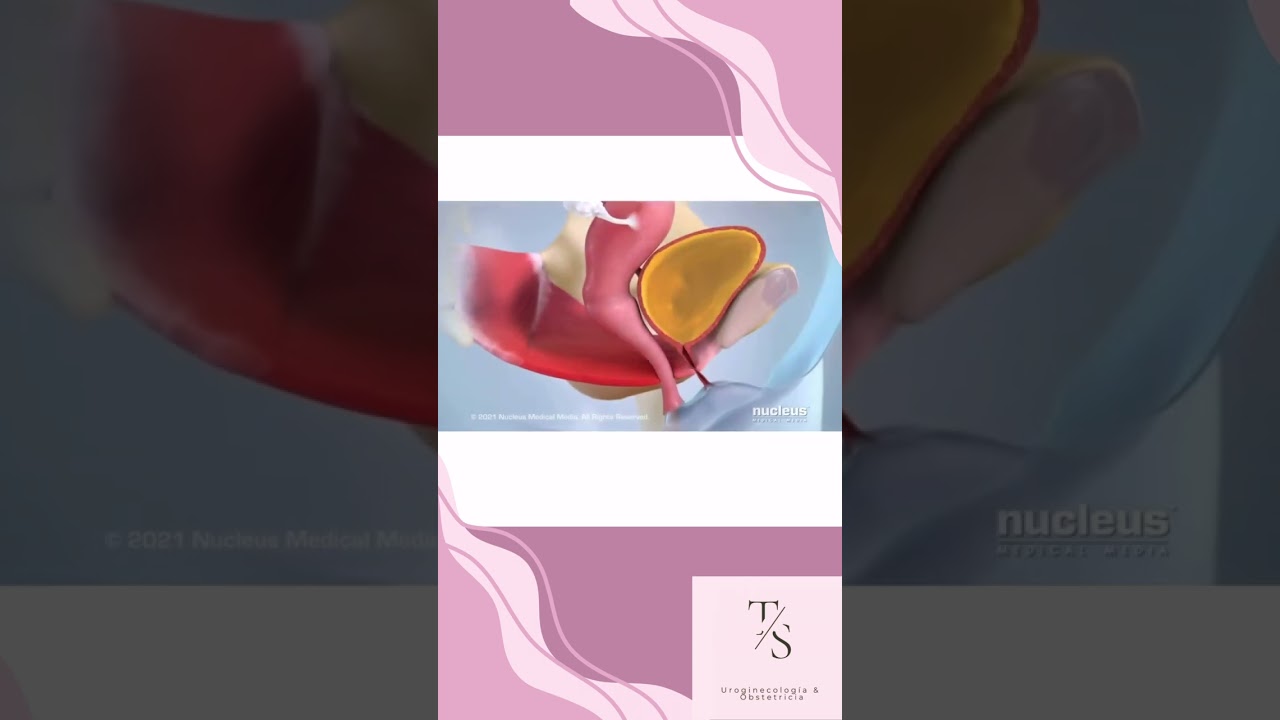 Treicy Sandoval Mariscal-15