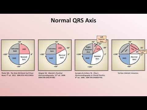 Intro to EKG Interpretation - Rate and Axis