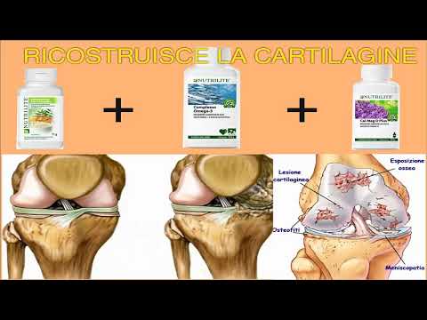 Metode de tratare a artrozei extremităților inferioare