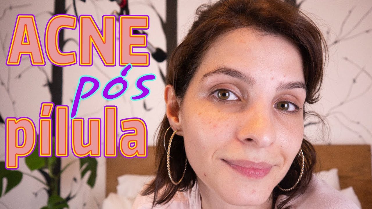 Parei a pílula, o que mudou?