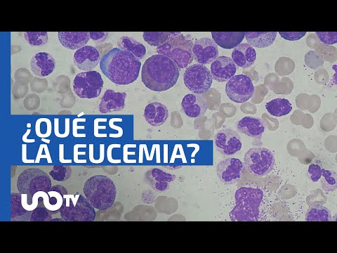 Leucemia: cómo y qué es este cáncer