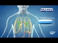 Treating Excess Mucus With Mucinex®| Living Well