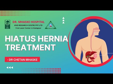 Hiatus Hernia Treatment | GERD Treatment | Acid Reflux Treatment - Chetan Mhaske