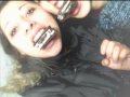 el otro yo - caries
