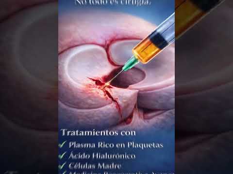 CLINICA DE ARTROSIS DEL TOLIMA