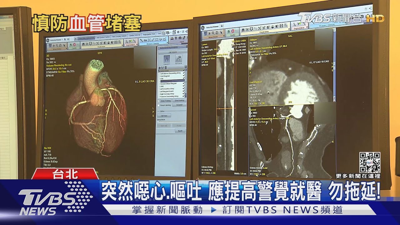 有片／出現頭暈、頭痛、臉歪嘴斜　醫師：這狀況恐怕要人命？