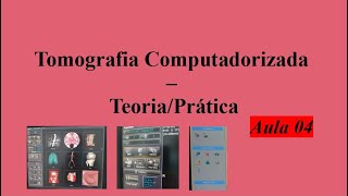 Curso de Tomografia - Aula 4 (MIP, MinIP, 3D)