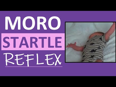 Moro Reflex Newborn Test | Startle Reflex | Pediatric Nursing Assessment