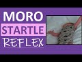 Moro Reflex Newborn Test | Startle Reflex | Pediatric Nursing Assessment