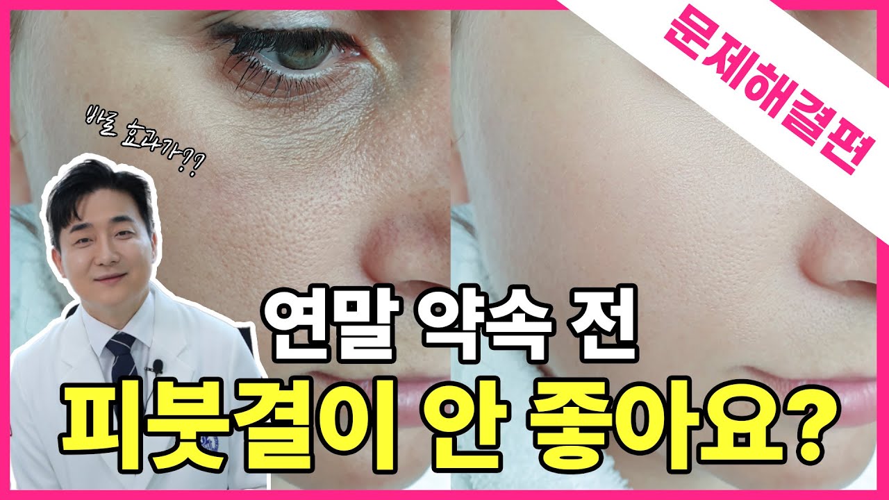 related_video_thumbnail