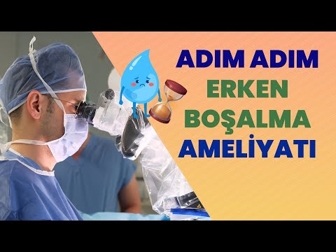 Bu Ameliyatla Erken Boşalma Son Buluyor! Adım Adım Uygulama