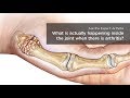 Inside an Arthritic Joint