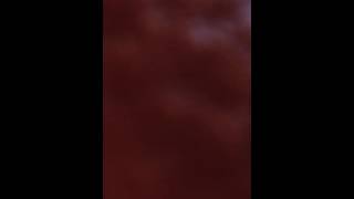 Radio interview with Brian and Betty