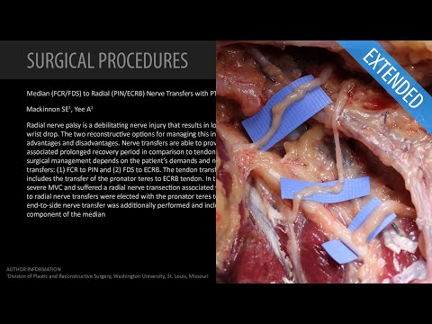 Transferts du nerf médian au nerf radial avec transfert du tendon PT vers ECRB - ​​étendue (avec Dr. Mackinnon)