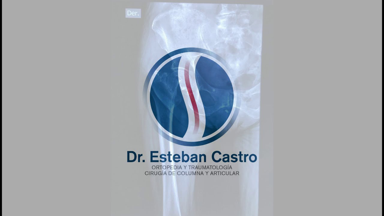 Esteban Castro Contreras-11