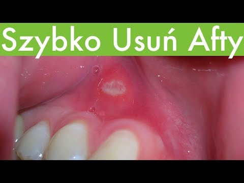 Maska do włosów wykonana z czerwonej papryki na porost włosów Maska do włosów wzrostu DIM