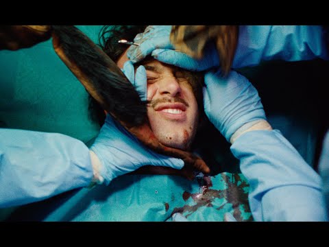 Provoker — It's In My Head (Official Video)