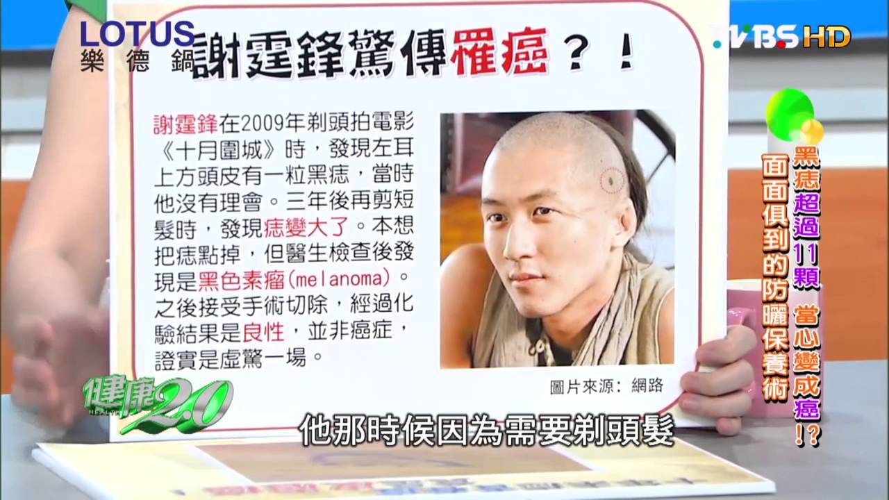 iskin盧靜怡院長受邀《健康兩點靈》金鋼狼也會得皮膚癌 1