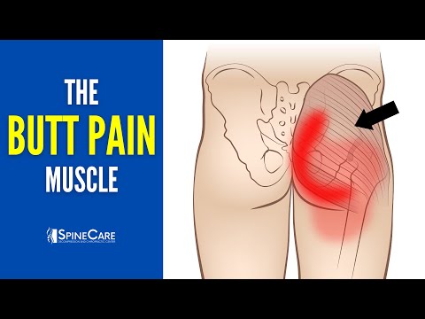 The Butt Pain Muscle (How to Release It for INSTANT RELIEF)