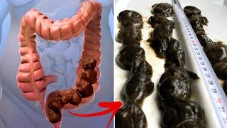 Natural Colon Cleanse Drink | Flush Out Tons Of Toxins From Body