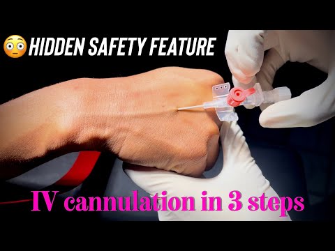 INTRAVENOUS CANNULATION IN 3 EASY STEPS