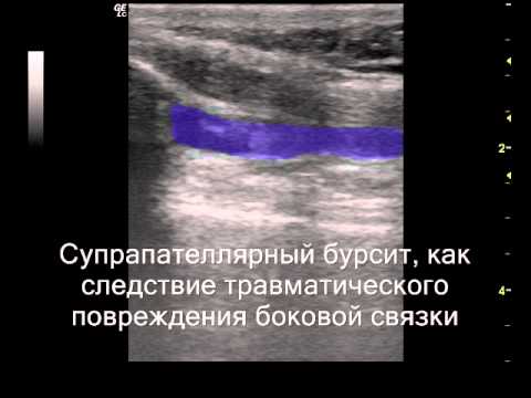 Клиника лечение позвоночника и суставов в люберцах Все о шейном остеохондрозе отзывы