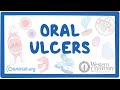 Western University - Oral Ulcers