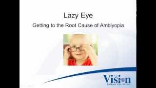 What is Lazy Eye?