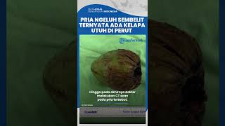 Pria Ini Ngeluh Sulit Kencing dan Sembelit, Ternyata Dokter Temukan Kelapa Utuh di Perut