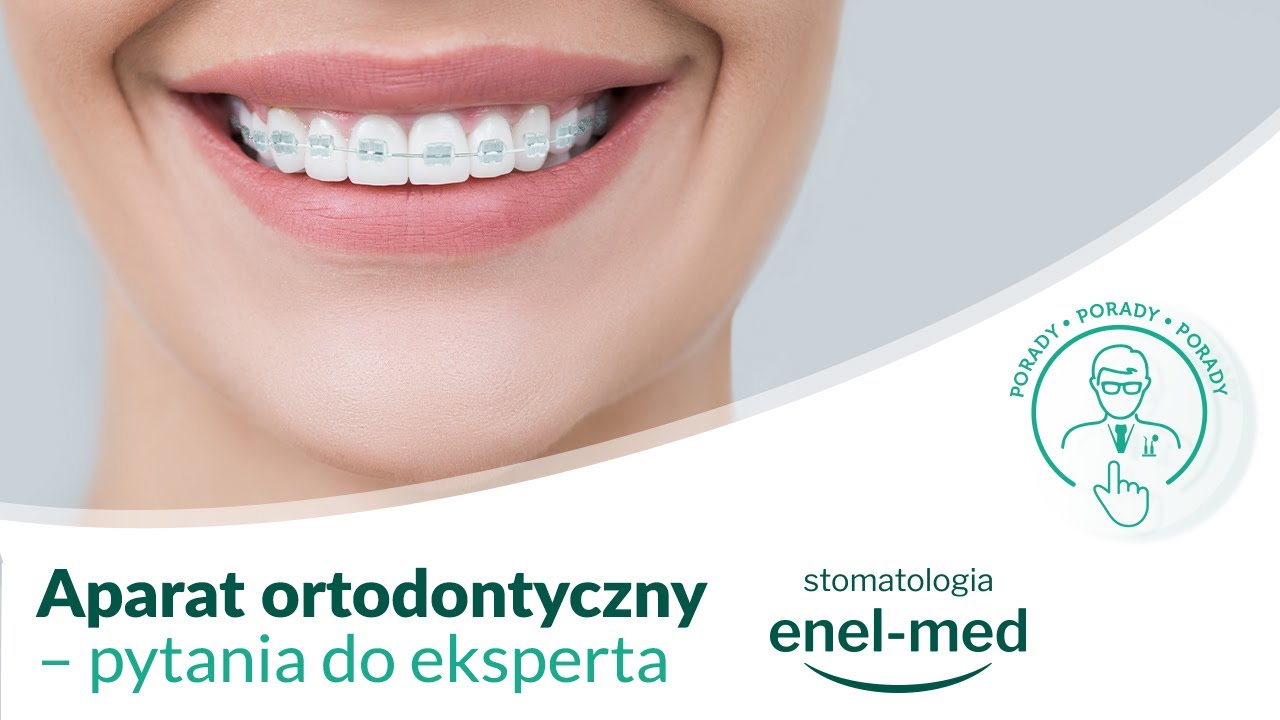 Aparat ortodontyczny - pytania do eksperta. Porady enel-med stomatologia.