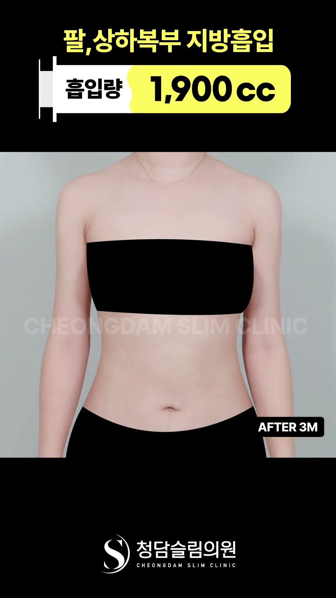 “핏 좋아졌다는 말 듣는 포인트” 👕