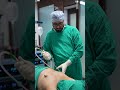 Gynecomastia Surgery Cost Shortvideo Shots Dezireclinicindia