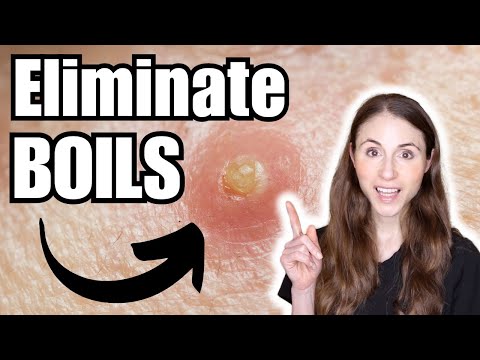 How To Get Rid Of Boils | Dermatologist Tips