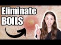 How To Get Rid Of Boils Dermatologist Tips