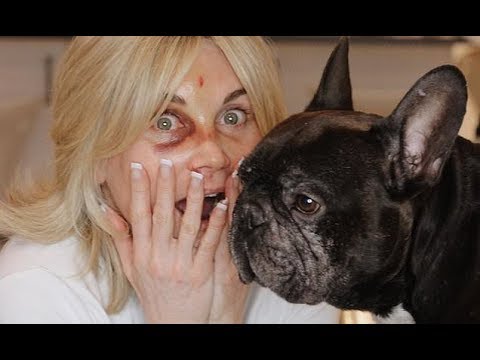 Anthea Turner sports painful looking BLACK EYE after 'face-planting' while attempting a backflip dur