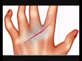 How to draw wounds in Paint Tool SAI 