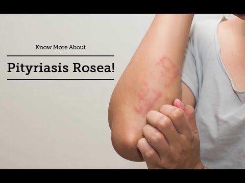 Video pag-alis ng kuko halamang-singaw Halamang-singaw sa mga tissue ng paa