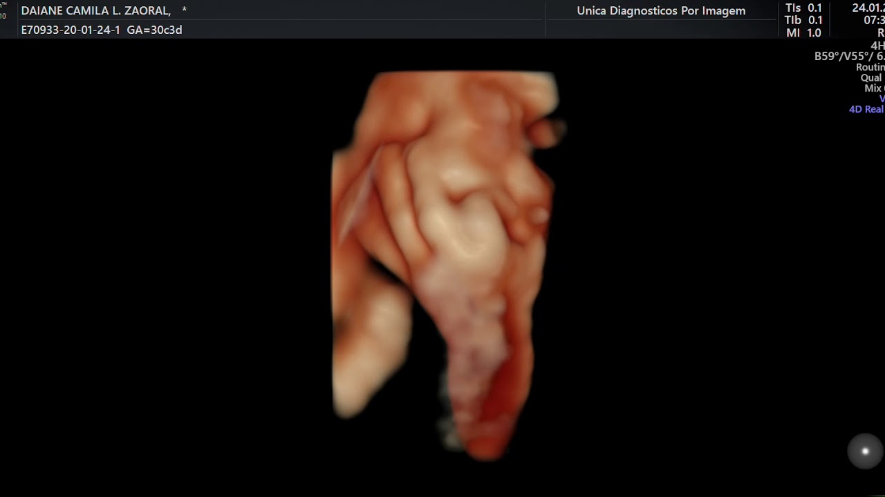 VÍDEO DE ULTRASSOM 3D 4D, MAOZINHA DO BEBE DE 30 SEMANAS