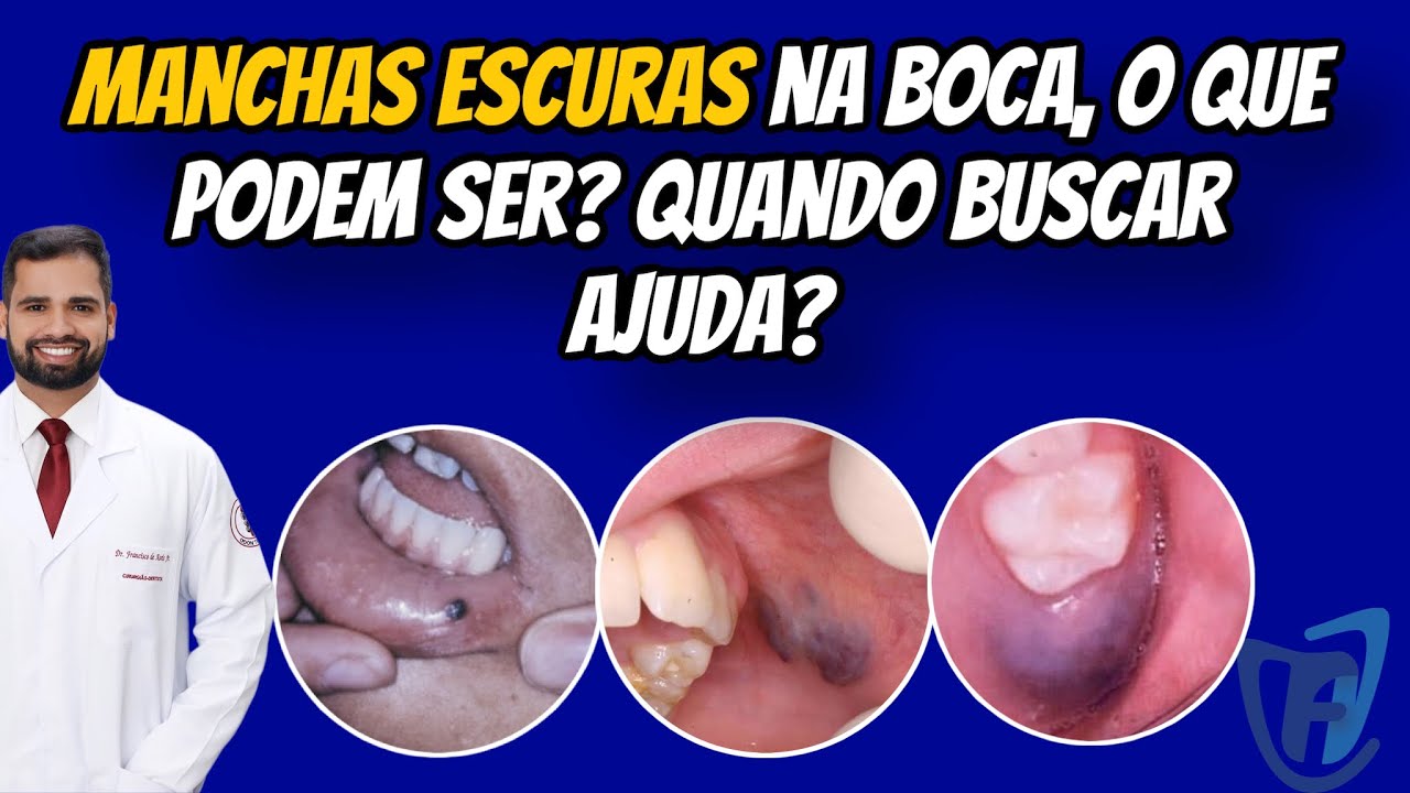 Francisco De Assis Almeida Lima Júnior-54