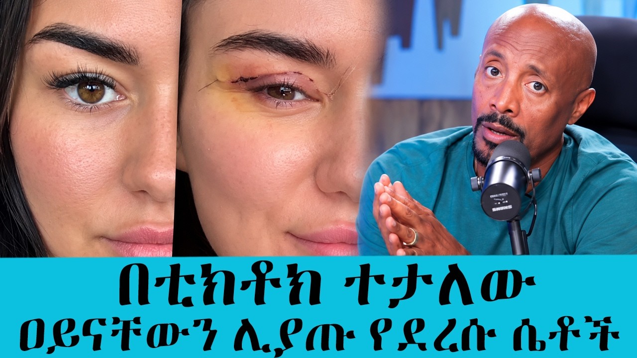 ቆንጆ ለመሆን ሄደው ዐይናቸውን መክደን አቃታቸው...በውበት ስም የተፈጸመው አሰቃቂ የ?