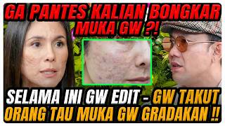 Download lagu NETIZEN BONGKAR MUKA WULAN ASLINYA GRADAKAN‼️ SAMPAI KE PSIKOLOG-NANGIS-HINGGA LUKA BR*K3N HOME ⁉️ mp3 Download lagu NETIZEN BONGKAR MUKA WULAN ASLINYA GRADAKAN‼️ SAMPAI KE PSIKOLOG-NANGIS-HINGGA LUKA BR*K3N HOME ⁉️ mp3