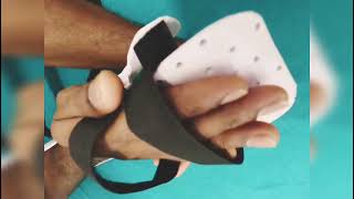 Functional Hand Splint