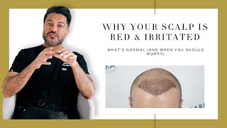 Canadian Hair Transplant Centre