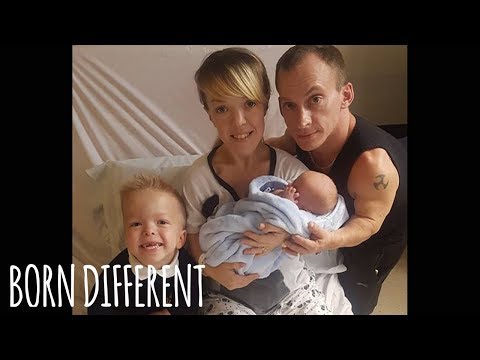 ‘UK’s Shortest Family’ Welcomes Second Baby With Dwarfism | BORN DIFFERENT