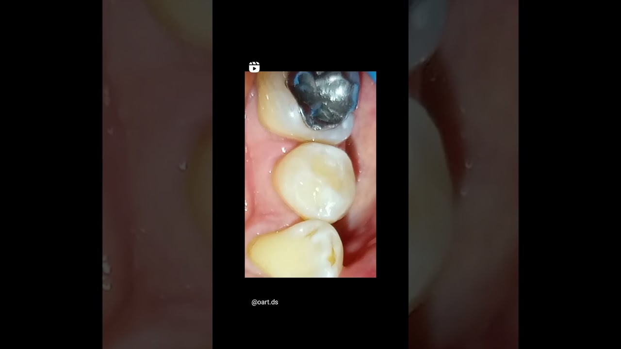 Oscar Justo Bustos-30