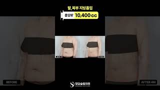 결혼 전 다이어트 중이라면, 필독❗