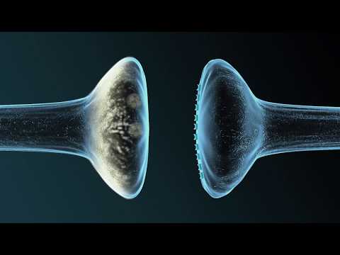 Parkinson – Was passiert im Kopf