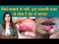 Mouth Ulcer यानी मुंह में छाले क्यों हो जाते ह