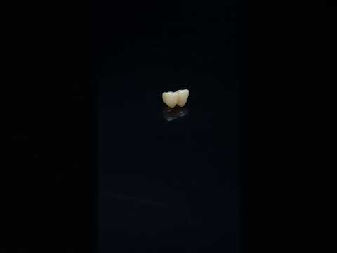 YouTube 썸네일