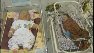 The 19 Pound Newborn